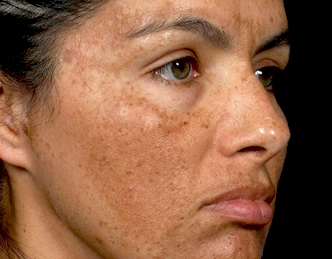 Image Source / Dr. Pimple Popper