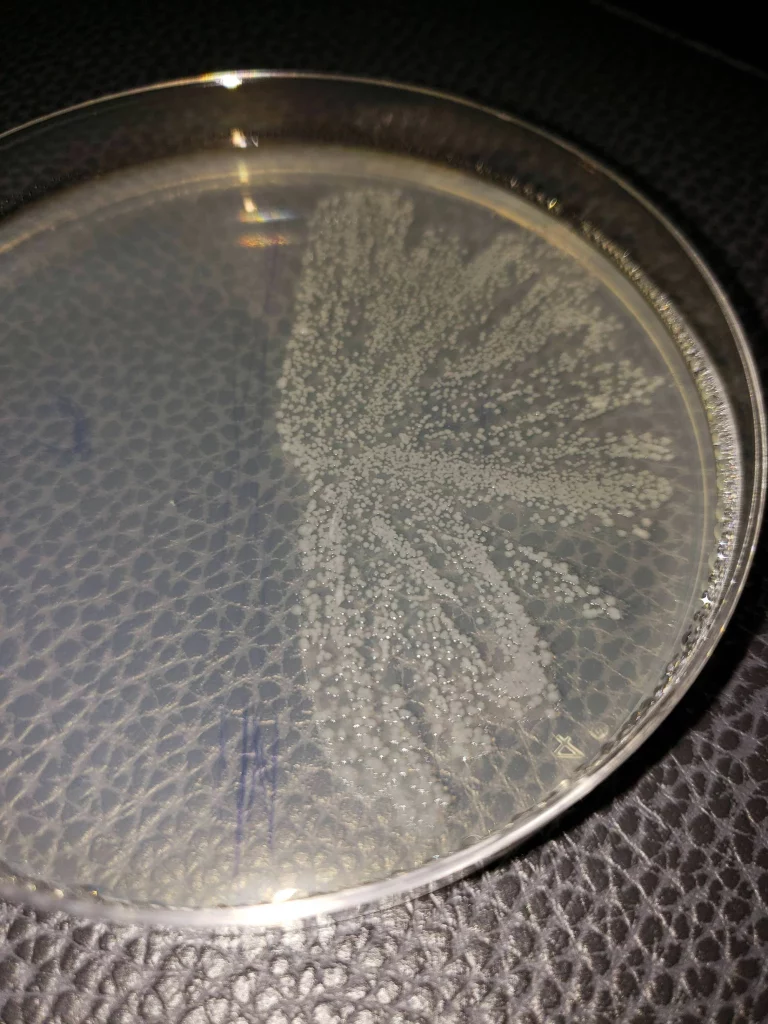 bacteria