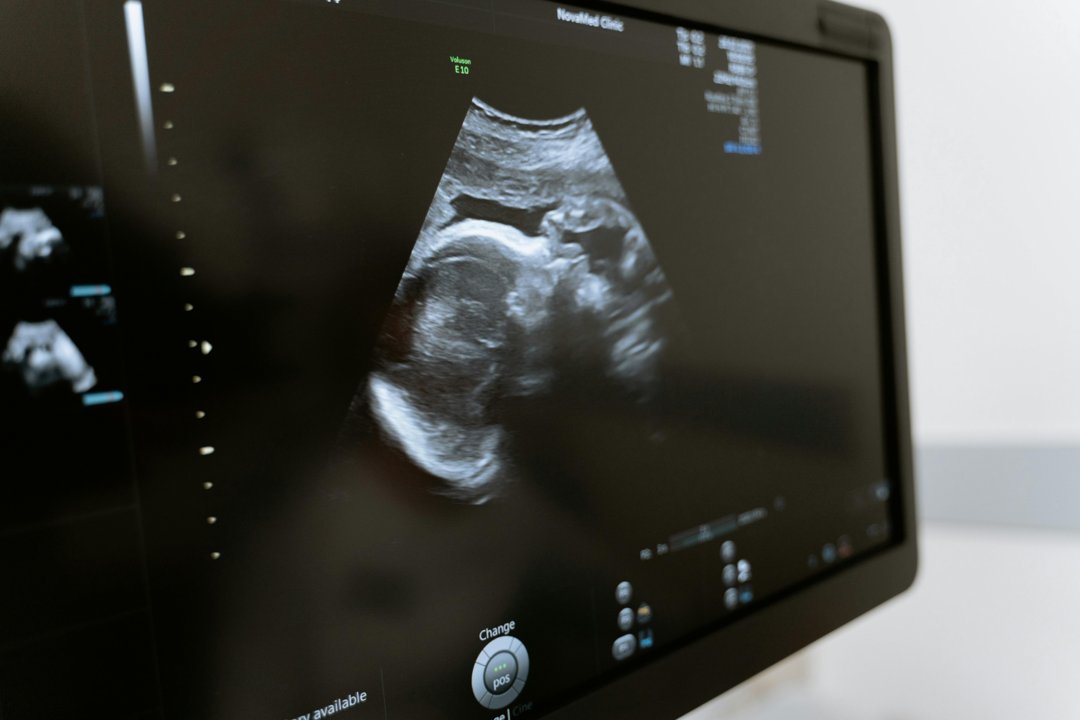 A sonogram of a baby during an ultrasound | Source: Pexels