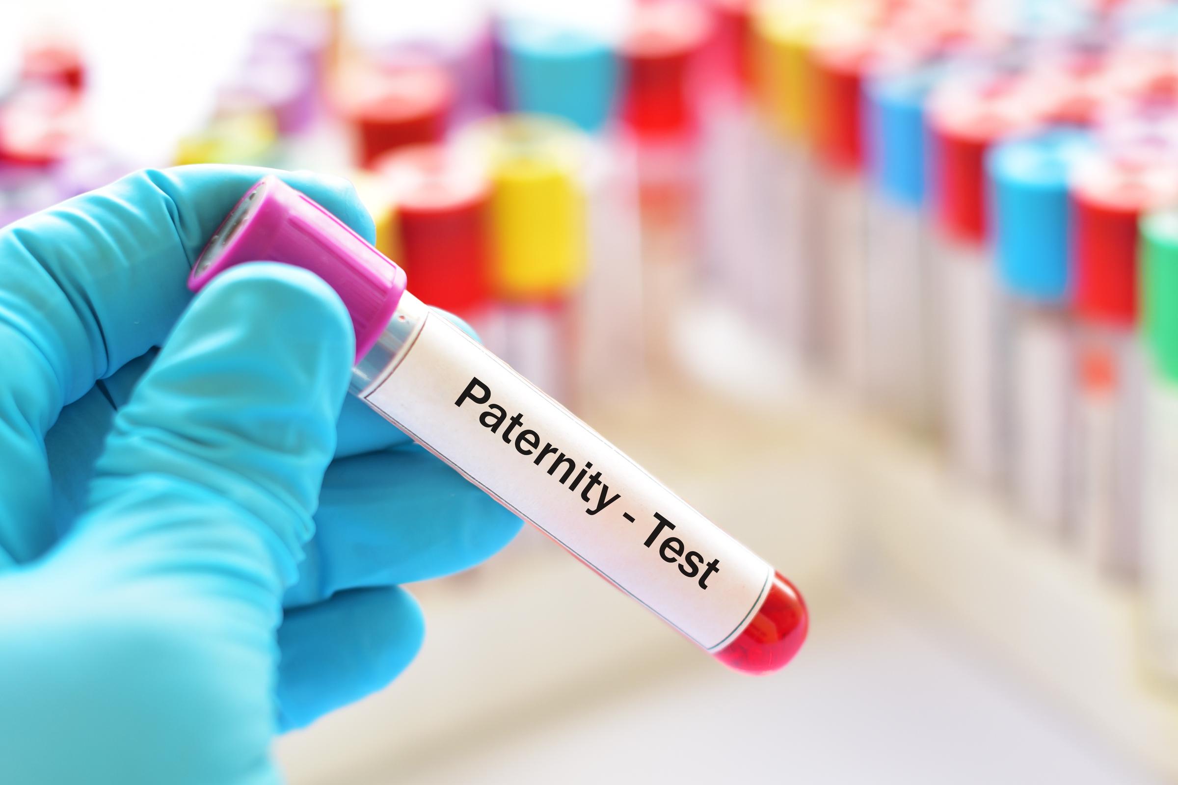 A blood sample for a paternity test | Source: Shutterstock