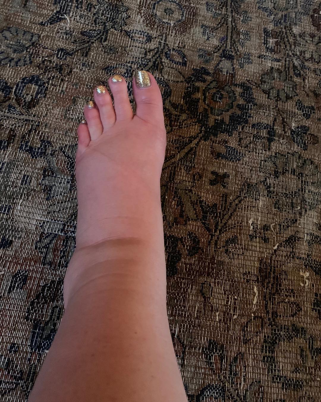 Jessica Simpson's swollen foot seen in a post dated January 11, 2019 | Source: Instagram/jessicasimpson