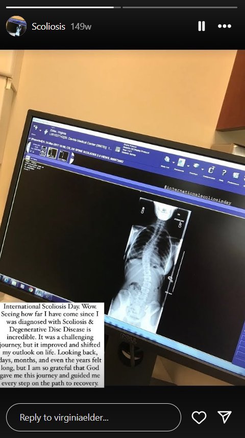 Virginia Elder reflects on her scoliosis diagnosis and recovery after years of treatment and faith-led resilience. | Source: Instagram/virginiaelder