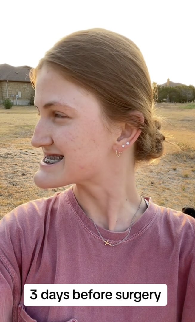 Smiling wide, Virginia Elder gives a glimpse of her pre-op profile with braces. | Source: TikTok/virginiaeelder