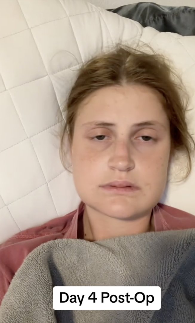 Virginia Elder at home, resting quietly on Day 4 of post-op recovery. | Source: TikTok/virginiaeelder