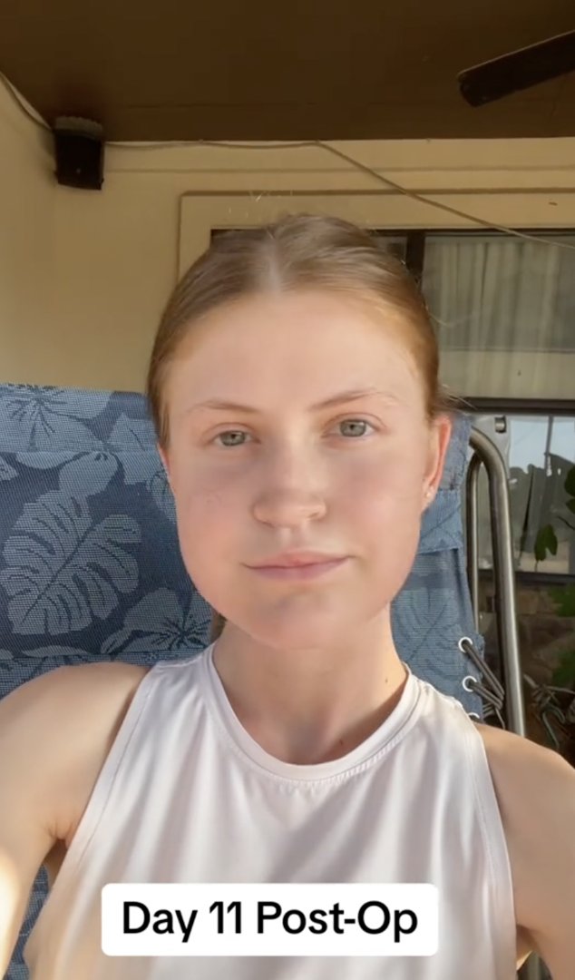 Virginia Elder appears outdoors on Day 11 post-op, framed by sunlight and a steady gaze. | Source: TikTok/virginiaeelder