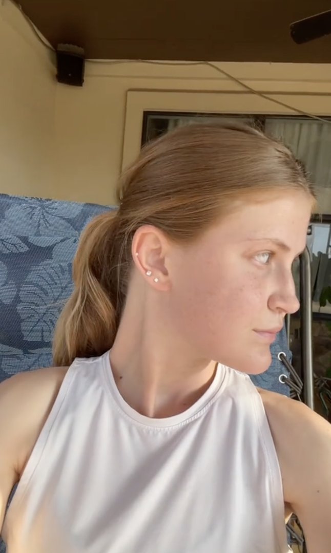 Virginia Elder looks to the side while seated outside, showing signs of steady healing. | Source: TikTok/virginiaeelder