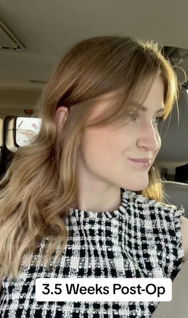Virginia Elder looks to the right, showing the change in her jaw. | Source: TikTok/virginiaeelder