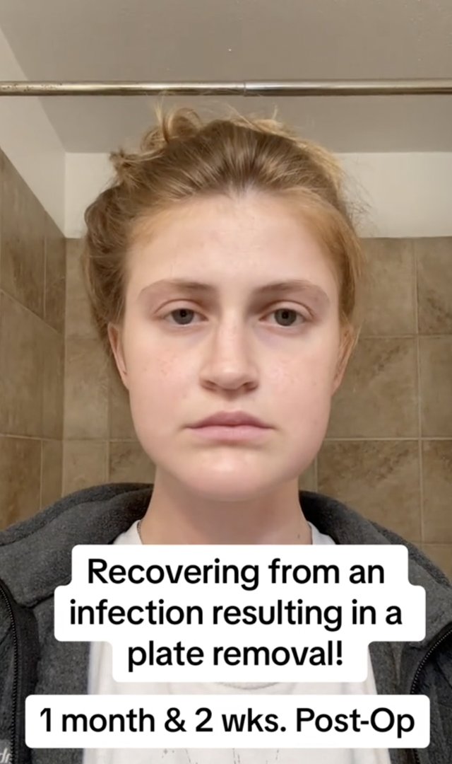 Virginia Elder shows a blank expression, documenting the toll of her recovery process. | Source: TikTok/virginiaeelder