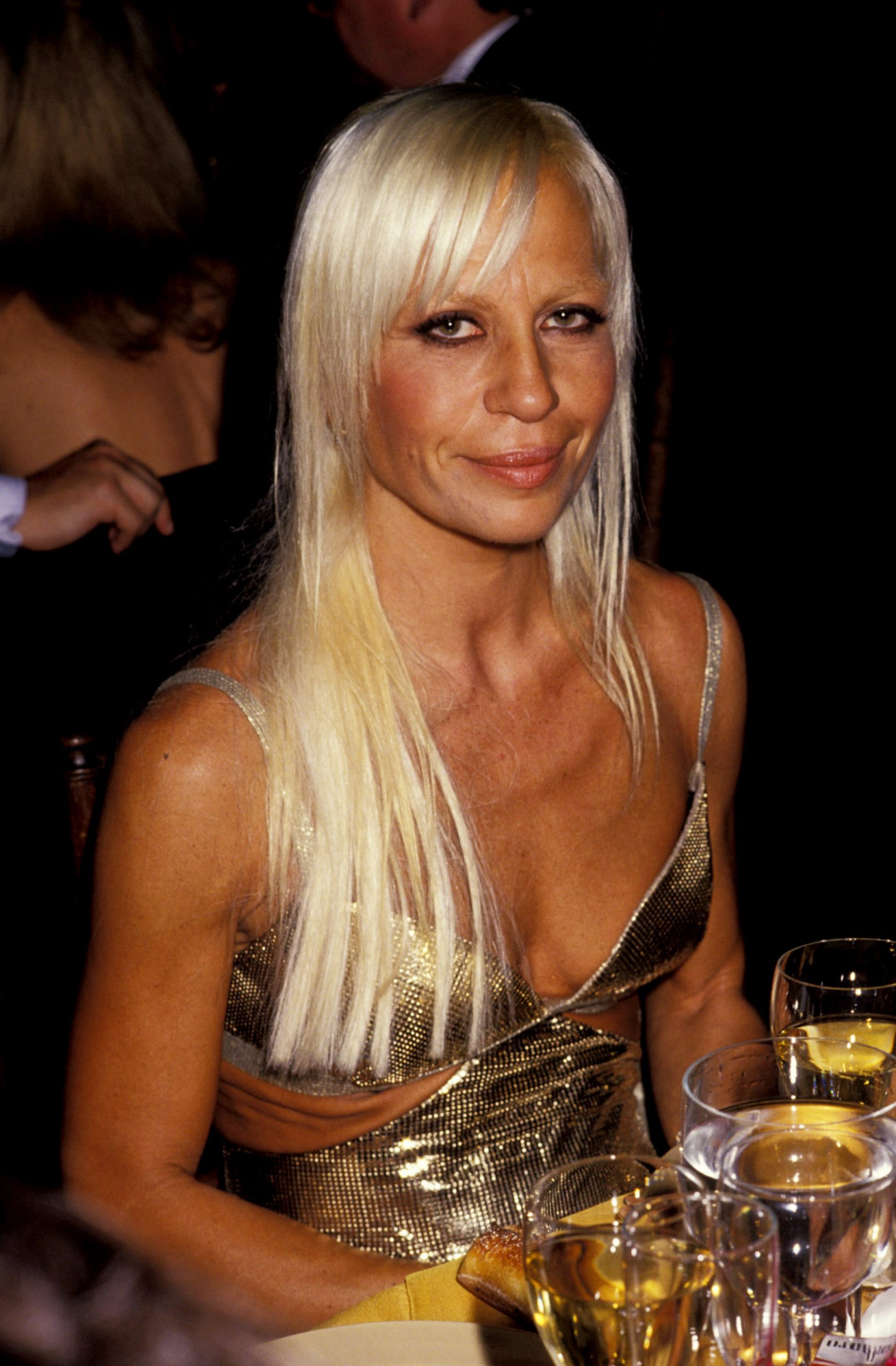 Donatella Versace, 39, attended The Fashion Group International Presents The 11th Annual Night of Stars on September 8, 1994, in New York City. Her face showed noticeably thinner and more defined cheek hollows, and a slightly wider mouth.