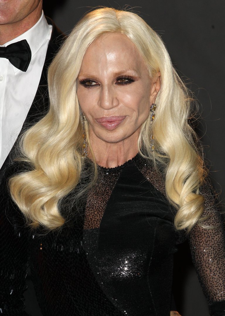 Donatella Versace, 58, attended the British Fashion Awards on December 2, 2013, at London Coliseum in London, England. Her face featured a sunken appearance beneath the eyes, deep horizontal lines visible across her forehead, and a tense, wide contour around her highly voluminous lips.