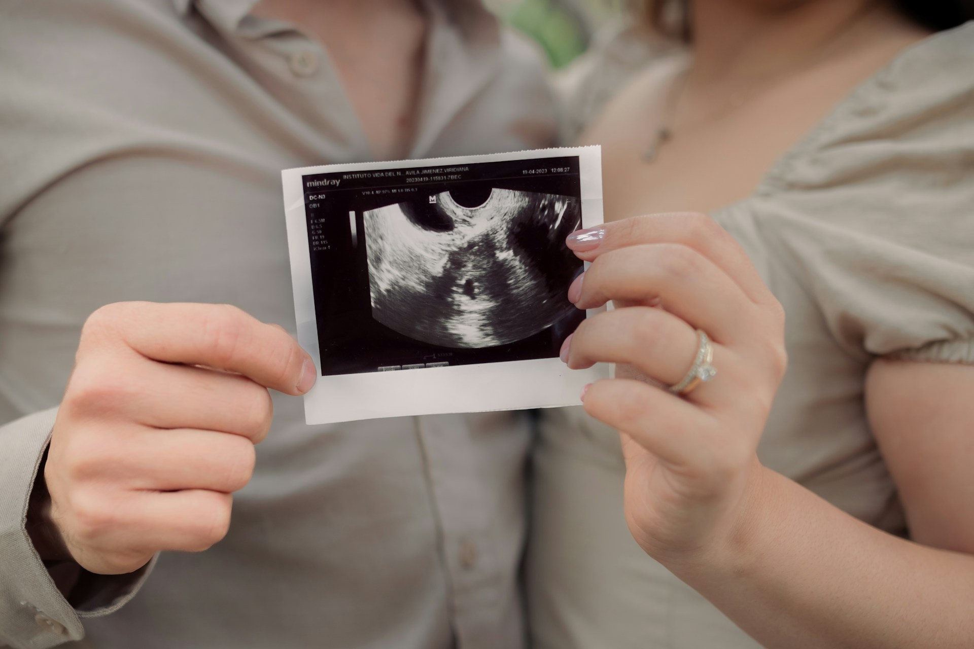 A couple holding an ultrasound scan image | Source: Unsplash