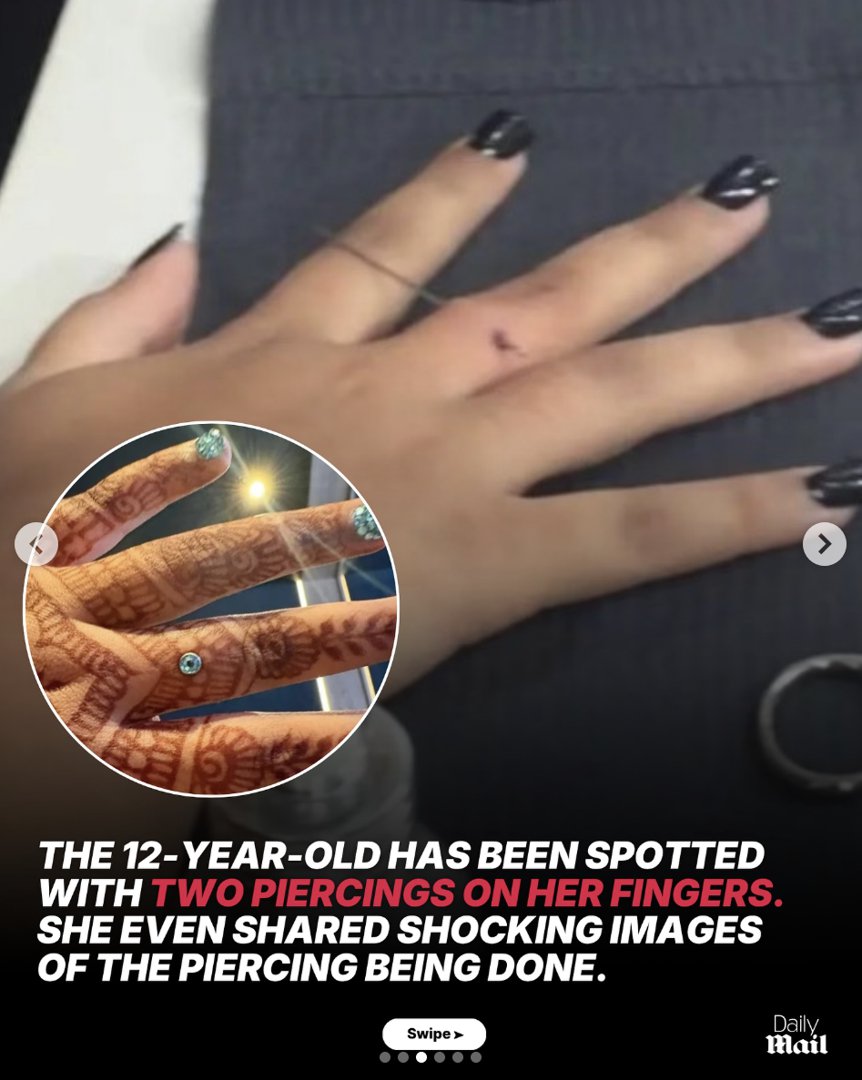 North West's dermal piercing once posted on her TikTok page, shared by Daily Mail on November 13, 2025. | Source: Instagram/dailymail