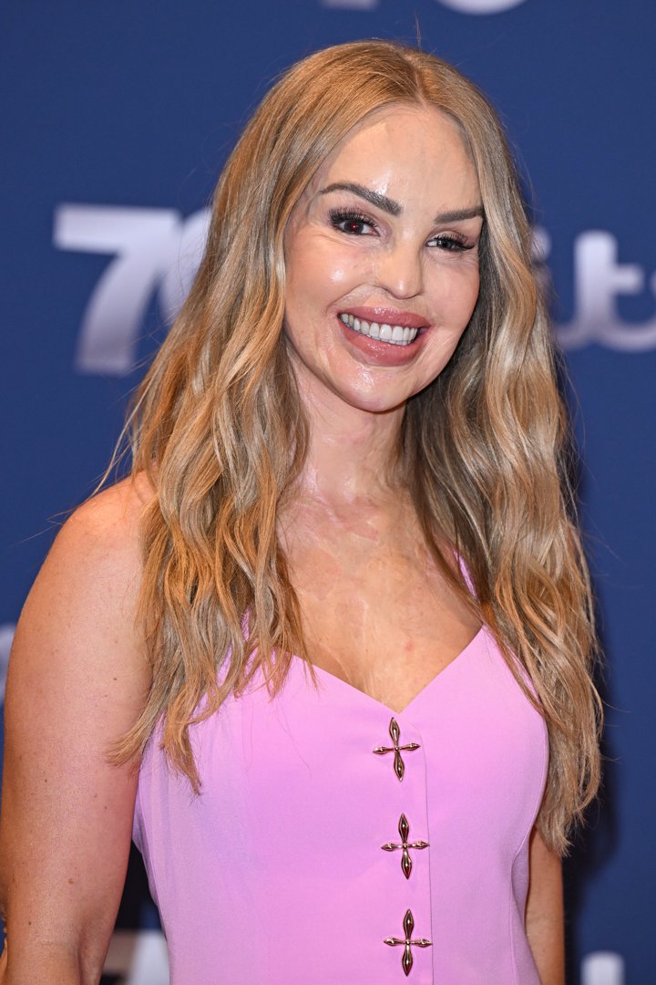 Katie Piper OBE attends the ITV 70th Anniversary Celebration at Guildhall on September 08, 2025 in London | Source: Getty Images