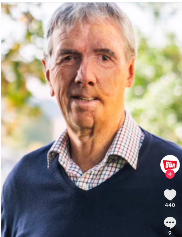 Dave Richards with his prosthetic face | Source: TikTok/TheDailyStar