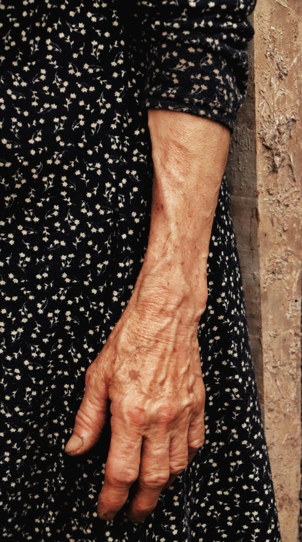 A woman's wrinkled arm | Source: Pexels