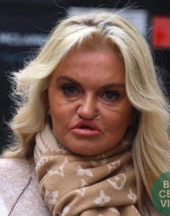 Danniella Westbrook appeared fresh-faced in a close-up image shared in a post dated February 23, 2026, as she debuted the results of her latest facial reconstruction surgery. Wearing a beige Louis Vuitton scarf wrapped closely around her neck and a soft-toned knit, the former EastEnders actress looked composed while standing against a backdrop of black railings and London townhouses. | Source: Facebook/Brit Celeb Vibes