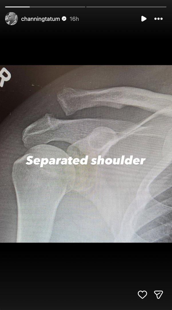 Channing Tatum documents his injury | Source: Instagram/channingtatum