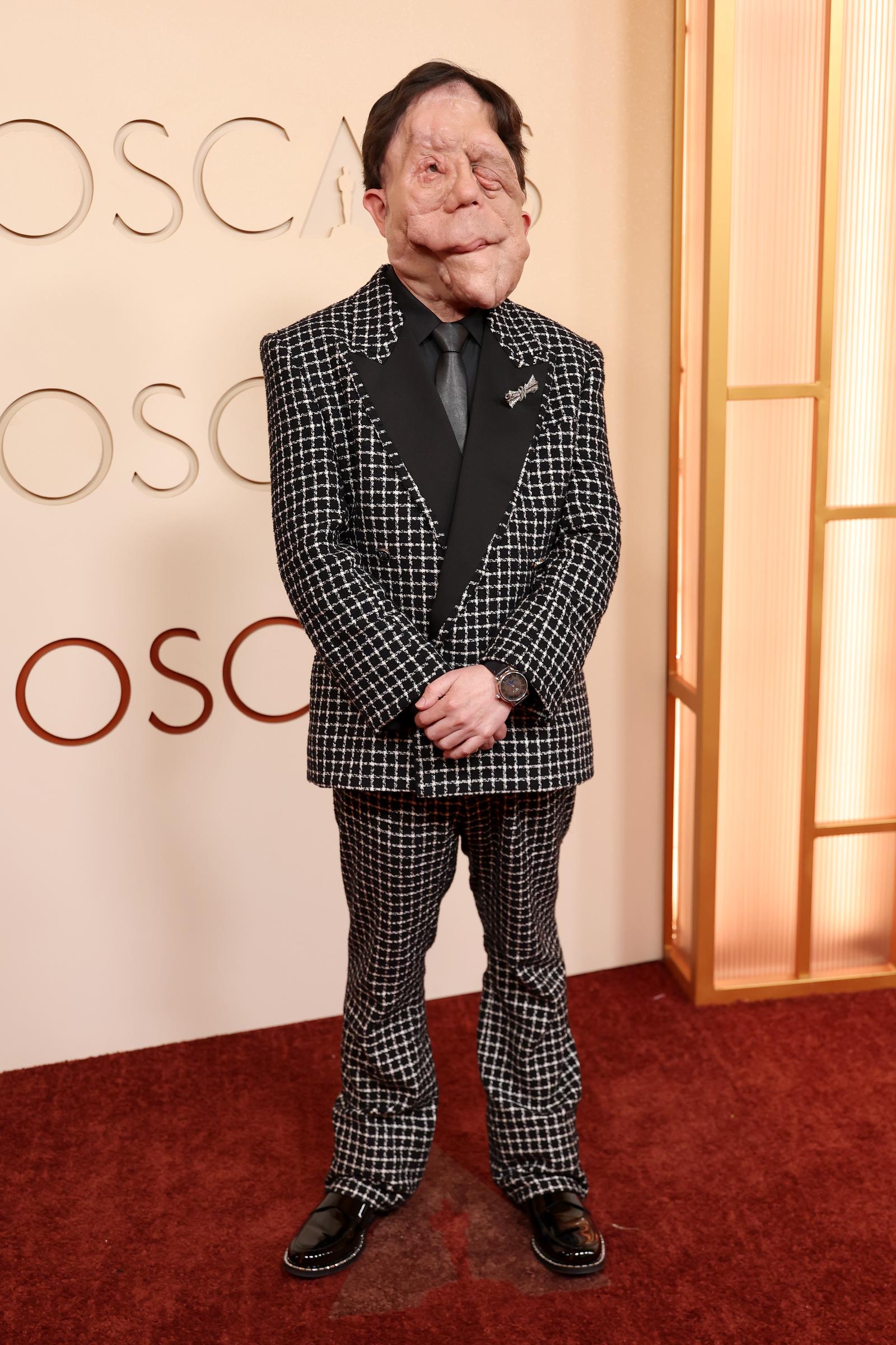 Adam Pearson was photographed on the red carpet at the 98th Academy Awards at the Dolby Theatre in California, United States, on 15 March 2026. He walked the carpet in a monochrome check Amiri suit with black satin lapels, a black shirt and tie, and a silver star-shaped brooch by Past and Precious on his chest. He stood with his hands clasped in front of the gold Oscar lettering on the ceremony's backdrop.