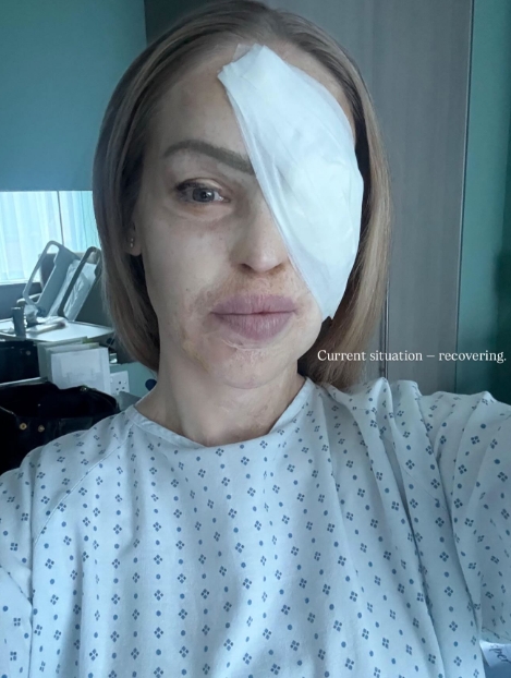 Katie Piper photographed in her hospital gown following one of her many surgical procedures in a post dated 11 December 2025. | Source: Facebook/Katie Piper